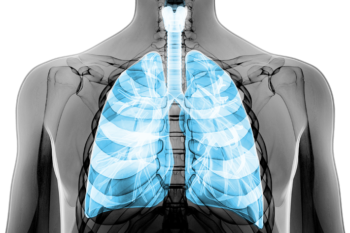 Graphical representation of a lung