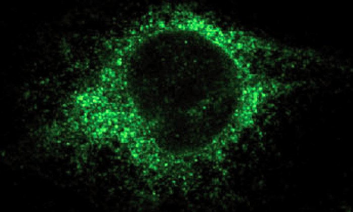 Die Färbung zeigt die Zielstruktur (PDI) in Brustkrebszellen. - Bild: LMU