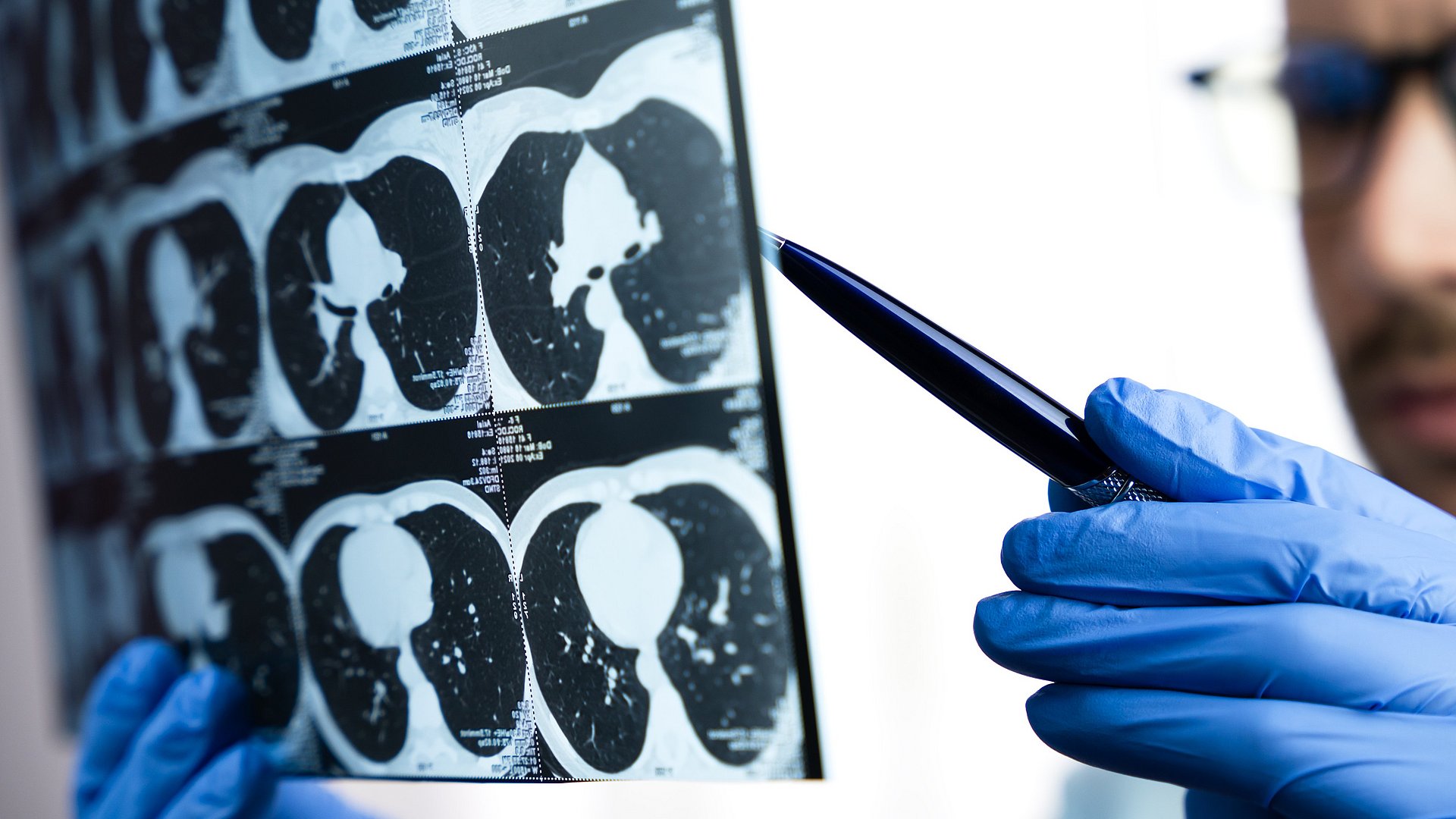 A doctor examining a CT scan