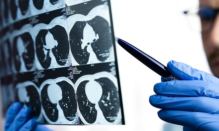 A doctor examining a CT scan