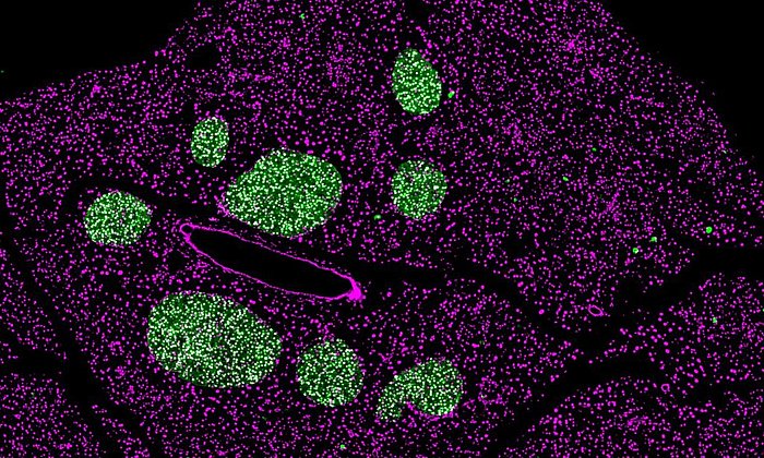Das Bild zeigt eine mikroskopische Aufnahme der Beta-Zellen einer erwachsenen Maus.