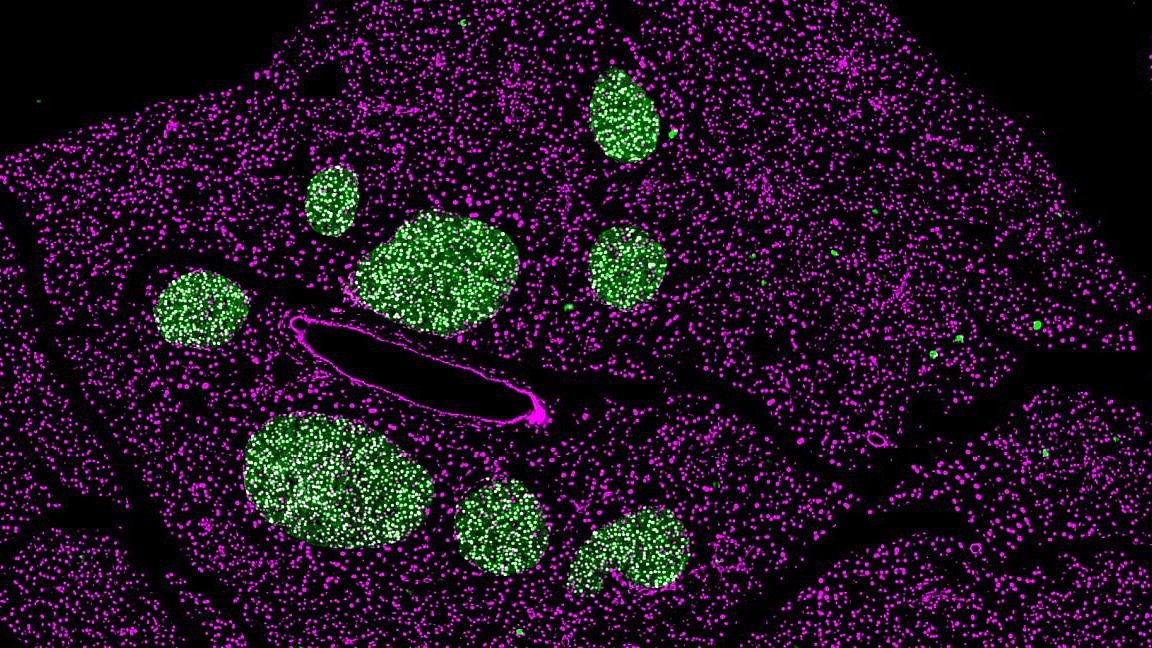 Das Bild zeigt eine mikroskopische Aufnahme der Beta-Zellen einer erwachsenen Maus.