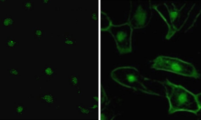 Autoantikörper binden an  Gliazellen