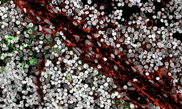 B cells in thymus tissue