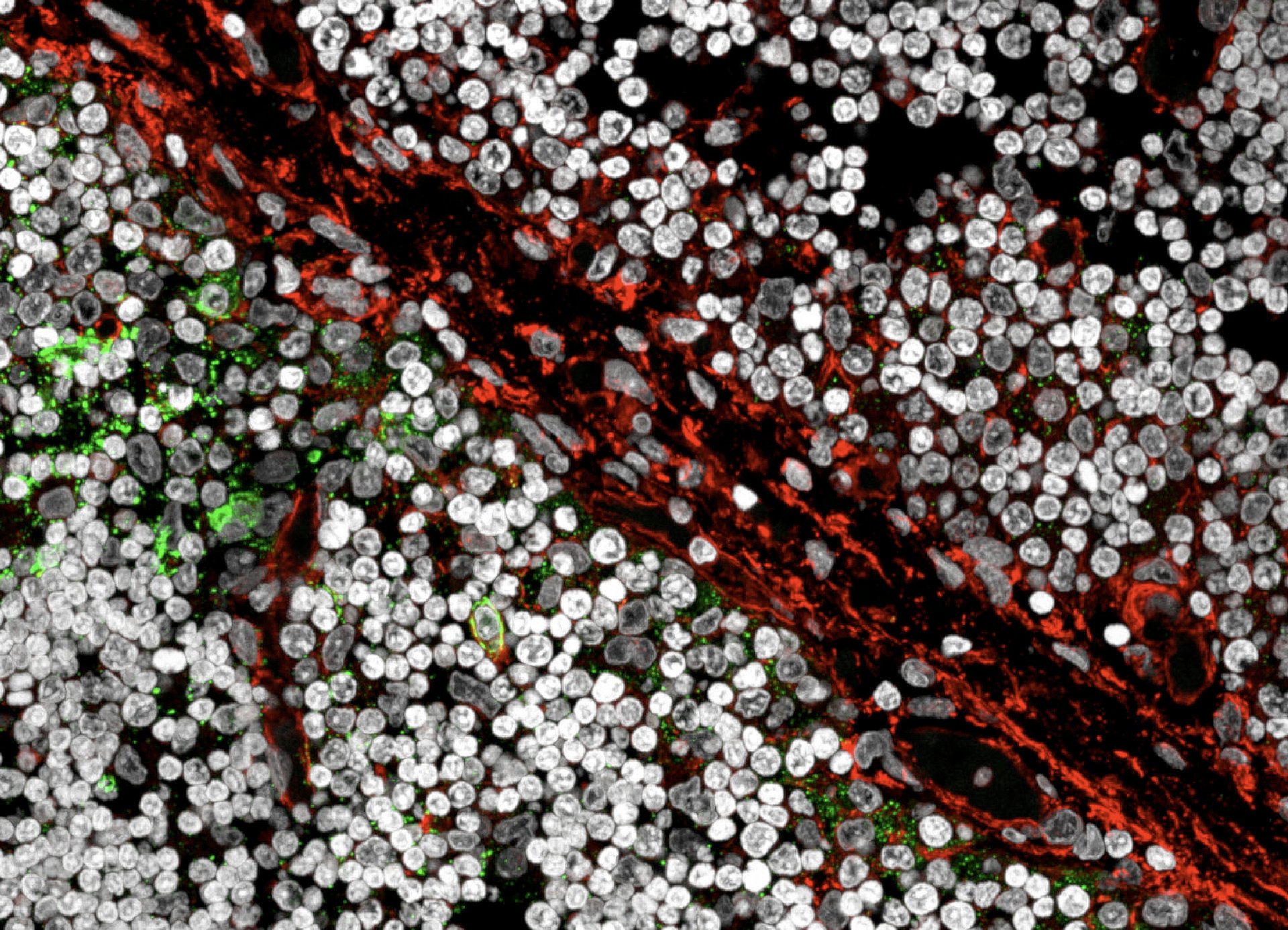 B cells in thymus tissue