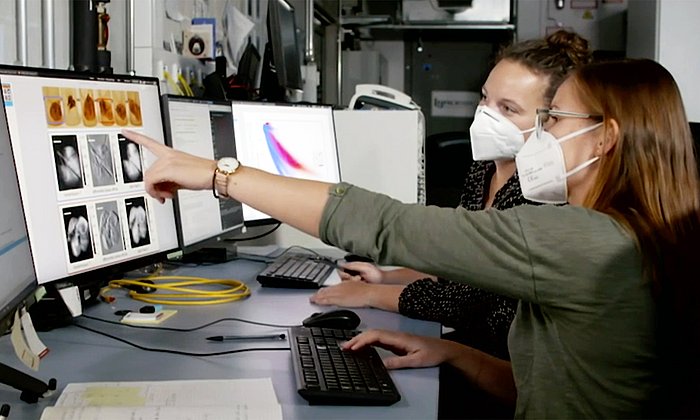 Dunkelfeld-Röntgenaufnahmen können die Schädigungen des Lungengewebes durch Erkrankungen wie COPD oder Covid-19 sichtbar machen.