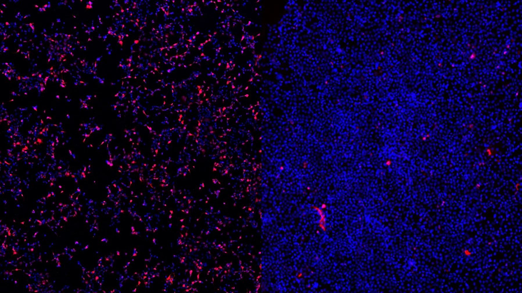 Zellaufnahme ASO-Therapien