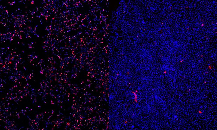 Zellaufnahme ASO-Therapien