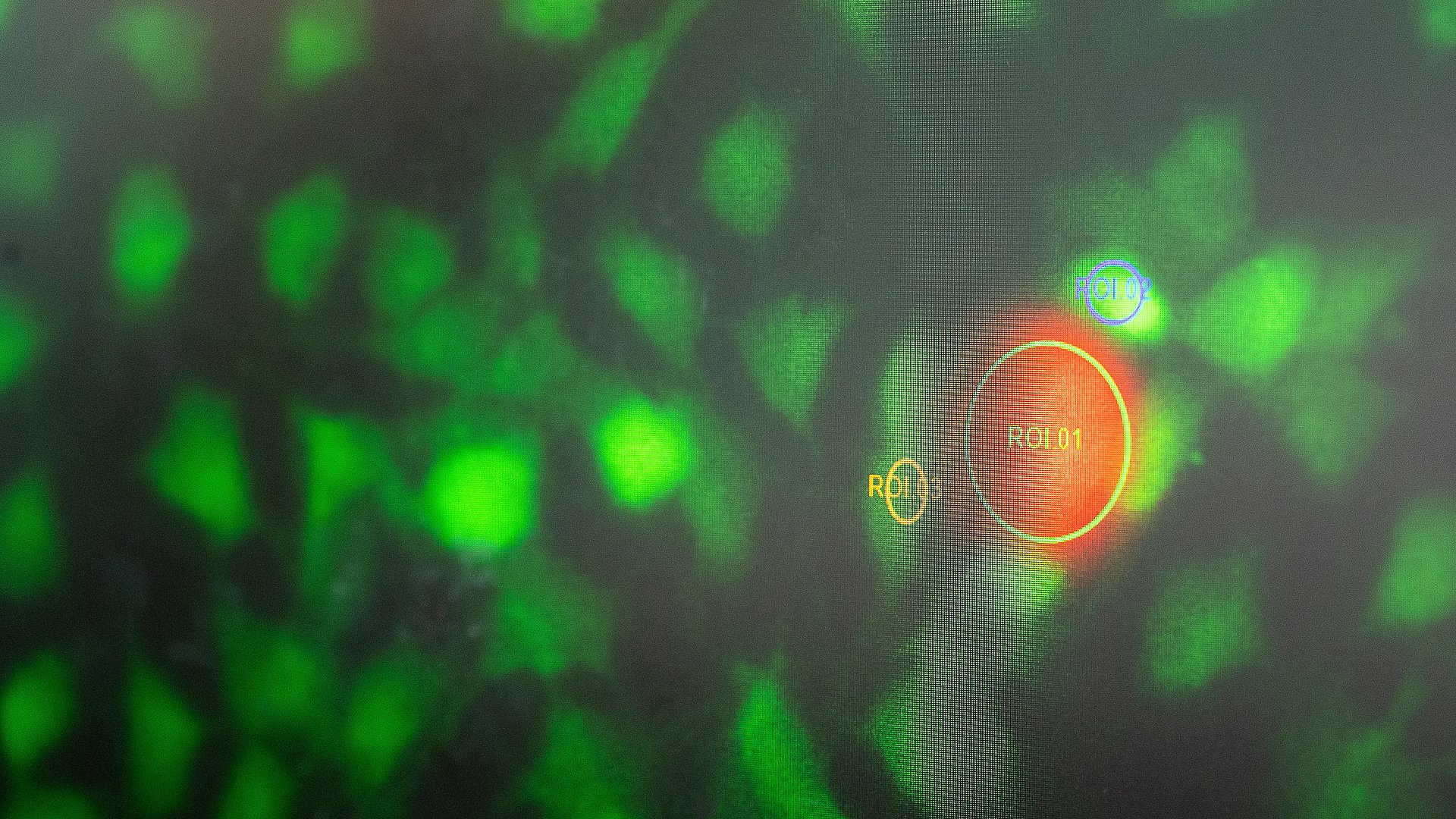 Ein Nanoroboter (orange) im Labor von Prof. Berna Özkale Edelmann