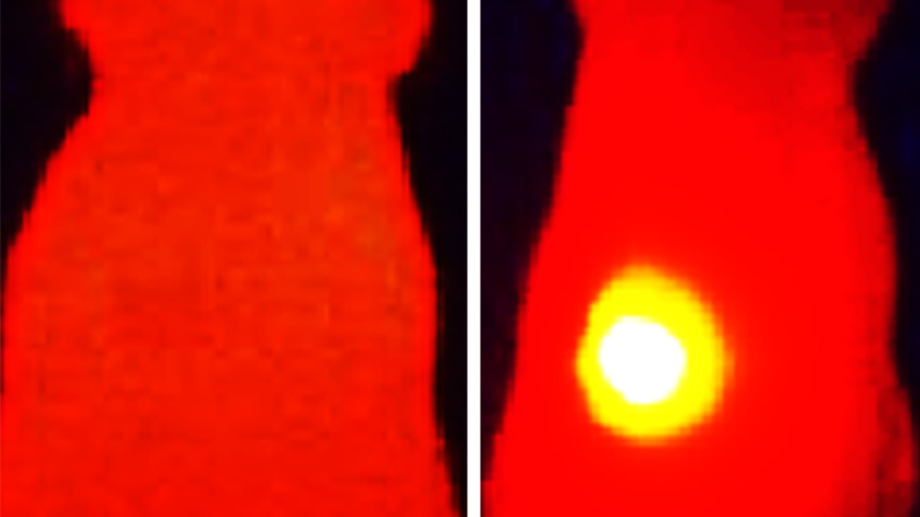 Infrared thermal images show elevated tumor (yellow) temperature in mice after laser irradiation in with OMV-melanin treated mice (right image). The image on the left shows a mouse treated with OMVs without melanin.