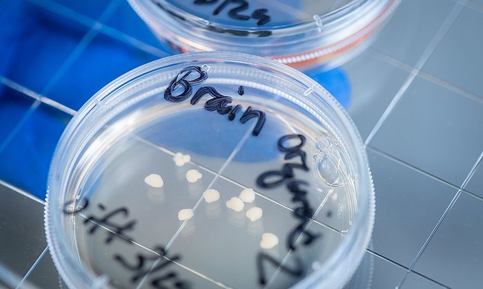 Gehirn-Organoide in einer Petrischale