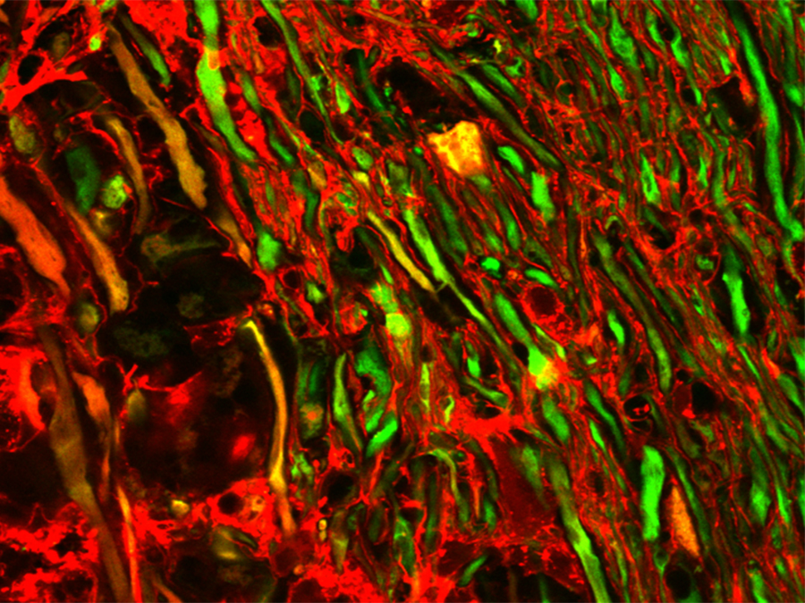 Microscopic image of the spinal cord: Damaged nerve fibers absorb a red fluorescent dye, axons without dye absorption appear green. (Image: M. Witte / LMU)