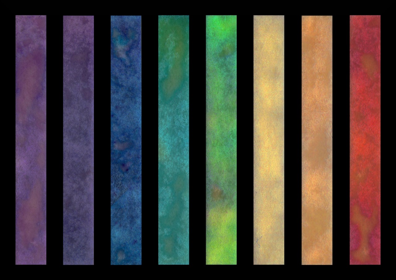 Verschiedenen farbige Teststreifen, die anzeigen ob eine Infektion uropathogener Bakterien vorliegt.